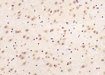 LIMK1 Rabbit Polyclonal Antibody