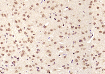 LIMK1 Rabbit Polyclonal Antibody