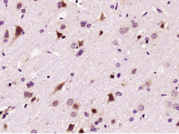 LIMK1 Rabbit Polyclonal Antibody