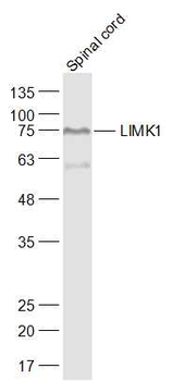 LIMK1 Rabbit Polyclonal Antibody