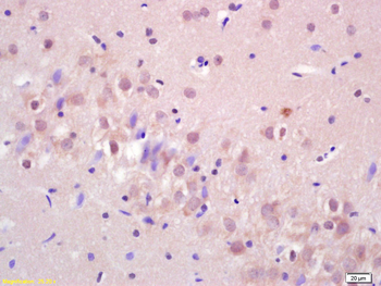 LIMK1 Rabbit Polyclonal Antibody