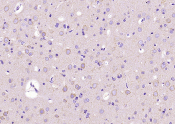 Phospho-LIMK1 (Thr508) + LIMK2 (Thr505) Rabbit Polyclonal Antibody