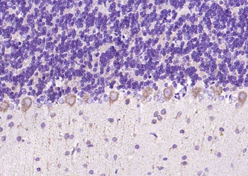 Phospho-LIMK1 (Thr508) + LIMK2 (Thr505) Rabbit Polyclonal Antibody