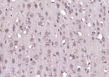 LKB1 Rabbit Polyclonal Antibody