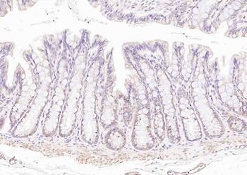LKB1 Rabbit Polyclonal Antibody