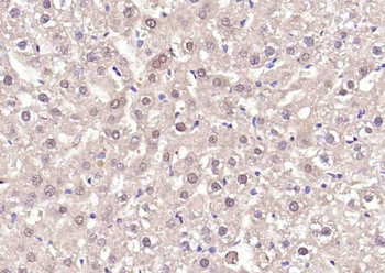 LKB1 Rabbit Polyclonal Antibody