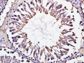 LKB1 Rabbit Polyclonal Antibody