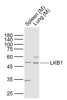 LKB1 Rabbit Polyclonal Antibody