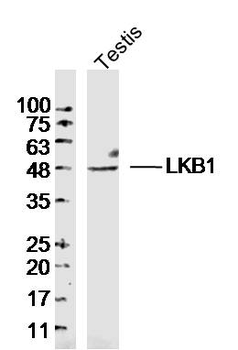 LKB1 Rabbit Polyclonal Antibody
