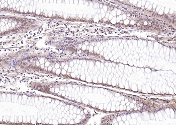 LKB1 Rabbit Polyclonal Antibody