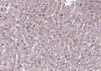 LKB1 Rabbit Polyclonal Antibody