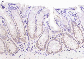 LKB1 Rabbit Polyclonal Antibody