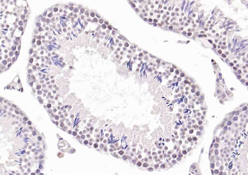 Phospho-LKB1 (Ser334) Rabbit Polyclonal Antibody