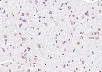 Phospho-LKB1 (Ser334) Rabbit Polyclonal Antibody