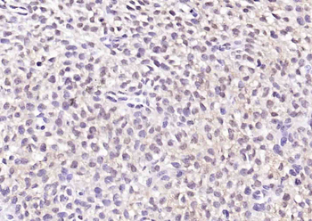 Phospho-LKB1 (Ser334) Rabbit Polyclonal Antibody