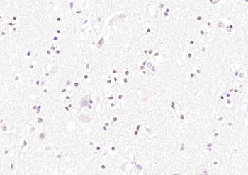 Phospho-LKB1 (Ser334) Rabbit Polyclonal Antibody