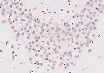 Phospho-LKB1 (Ser334) Rabbit Polyclonal Antibody