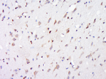 Lipoprotein lipase Rabbit Polyclonal Antibody