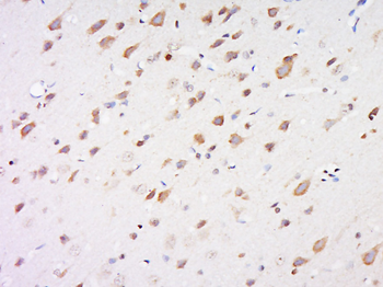 Lipoprotein lipase Rabbit Polyclonal Antibody