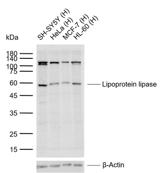 Lipoprotein lipase Rabbit Polyclonal Antibody