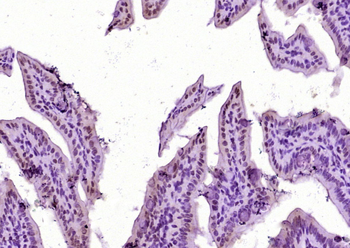 LPP Rabbit Polyclonal Antibody