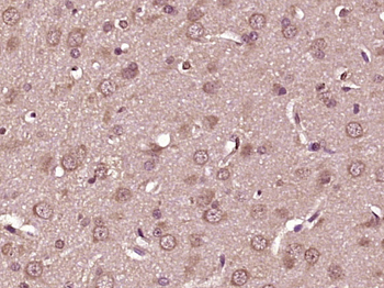 LTA4H Rabbit Polyclonal Antibody