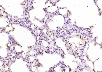 Phospho-Lyn (Tyr397) Rabbit Polyclonal Antibody