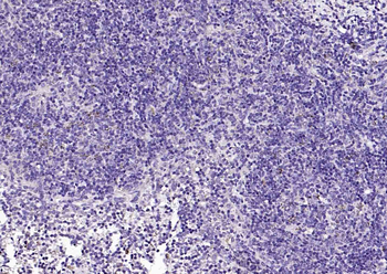 Phospho-Lyn (Tyr397) Rabbit Polyclonal Antibody