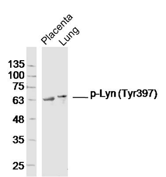 Phospho-Lyn (Tyr397) Rabbit Polyclonal Antibody