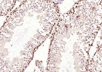 LYK5 Rabbit Polyclonal Antibody