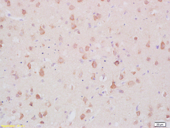 MARCKS Rabbit Polyclonal Antibody