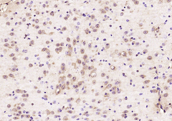 Phospho-MARCKS (Ser170) Rabbit Polyclonal Antibody