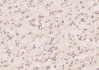 Phospho-MARCKS (Ser170) Rabbit Polyclonal Antibody