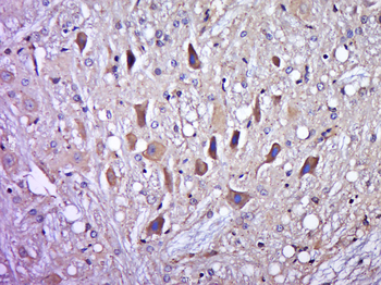 Phospho-DAXX (Ser213) Rabbit Polyclonal Antibody