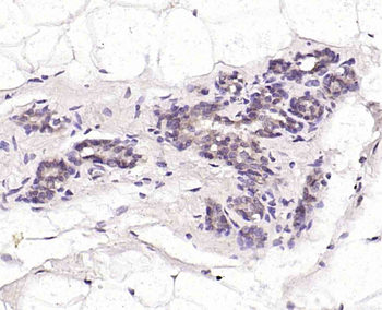 Phospho-DAXX (Ser517) Rabbit Polyclonal Antibody