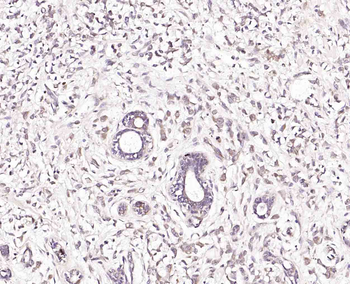 Phospho-DAXX (Ser671) Rabbit Polyclonal Antibody