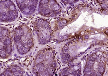 MATR3 Rabbit Polyclonal Antibody