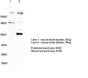 MAP3K8 Rabbit Polyclonal Antibody