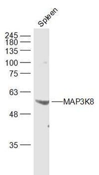 MAP3K8 Rabbit Polyclonal Antibody