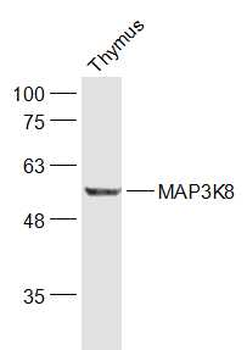 MAP3K8 Rabbit Polyclonal Antibody
