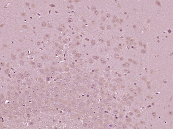 Phospho-MAP3K8 (Ser400) Rabbit Polyclonal Antibody