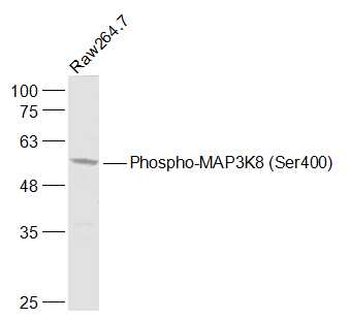 Phospho-MAP3K8 (Ser400) Rabbit Polyclonal Antibody