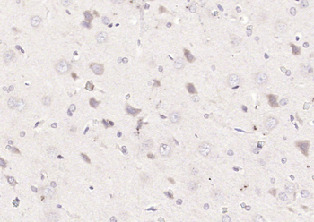 Phospho-MAP3K8 (Thr290) Rabbit Polyclonal Antibody