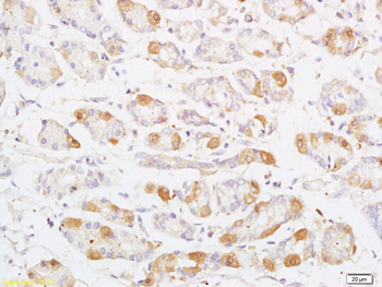 Phospho-MAP3K8 (Thr290) Rabbit Polyclonal Antibody