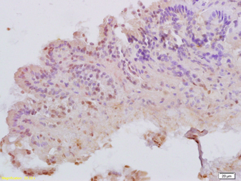 MATH1 Rabbit Polyclonal Antibody