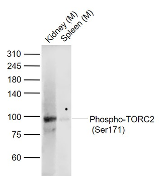 Phospho-TORC2 (Ser171) Rabbit Polyclonal Antibody