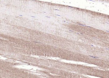 MAPKAP Kinase 2 Rabbit Polyclonal Antibody