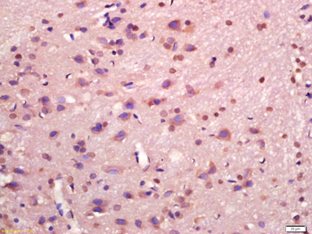 MAPKAP Kinase 2 Rabbit Polyclonal Antibody