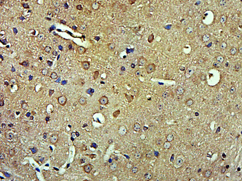 Phospho-MEK2 (Thr394) Rabbit Polyclonal Antibody