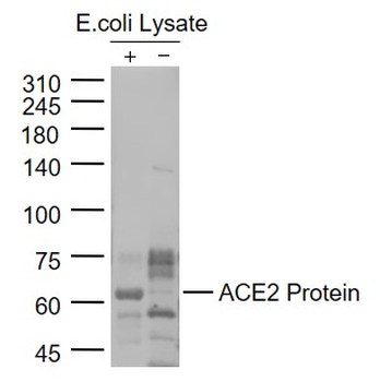 ACE2 Rabbit Polyclonal Antibody